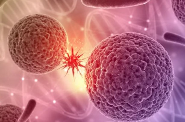 Foto - Çarpıcı kanser kanser araştırması! Vakaların yüzde 40'ı hızla yayılan sorunla ilgili