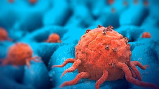 Çarpıcı kanser kanser araştırması! Vakaların yüzde 40'ı hızla yayılan sorunla ilgili