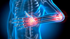 Foto - Çelik gibi kemiklerin anahtarı! Her gün 3 adet tüketmek yetiyor... Kızılcık meyvesi: Aynı şifa deposu, ezber bozdu