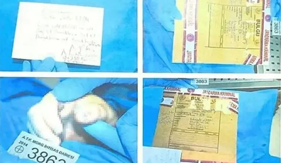 Foto - Cem Garipoğlu'nun elindeki mor lekelerin sırrı ortaya çıktı