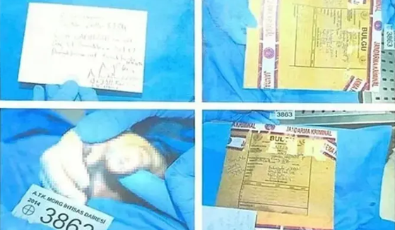 Foto - Cem Garipoğlu'nun elindeki mor lekelerin sırrı ortaya çıktı