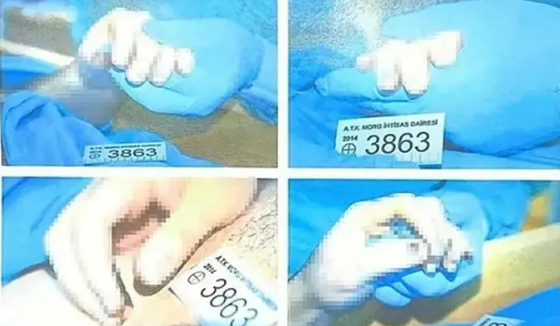 Foto - Cem Garipoğlu'nun elindeki mor lekelerin sırrı ortaya çıktı