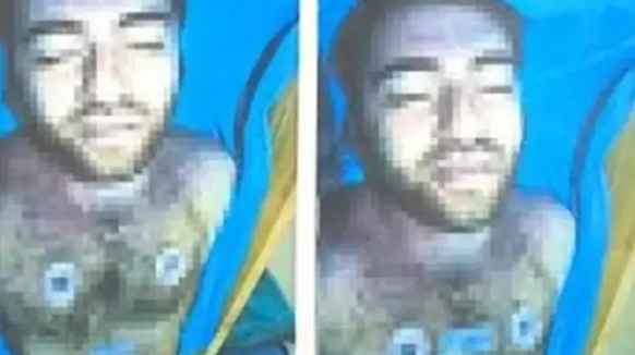 Foto - Cem Garipoğlu'nun elindeki mor lekelerin sırrı ortaya çıktı