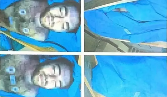 Foto - Cem Garipoğlu'nun elindeki mor lekelerin sırrı ortaya çıktı