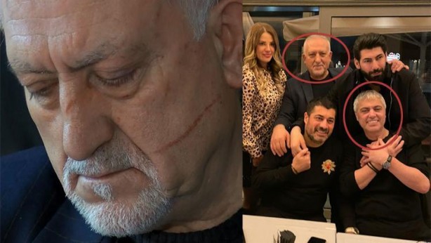 Foto - Cengiz Kurtoğlu'na büyük şok! Ceza aldı! Hiç kimse bunu beklemiyordu
