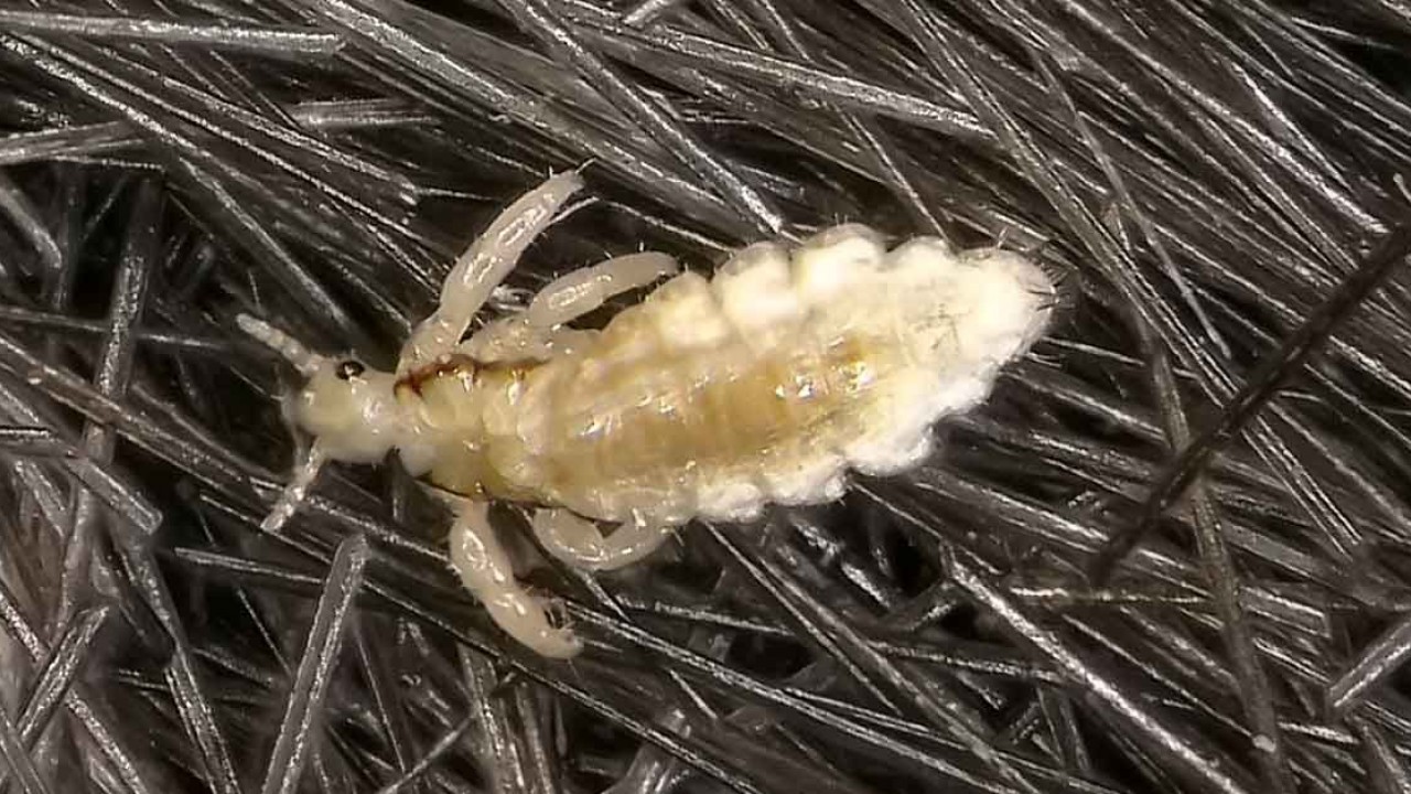 Foto - CHP yüzünden susuzluktan bitlenen İzmir halkı ne yapmalı? Bite karşı mücizevi bitkisel çözüm