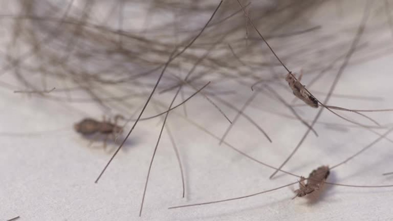 Foto - CHP yüzünden susuzluktan bitlenen İzmir halkı ne yapmalı? Bite karşı mücizevi bitkisel çözüm