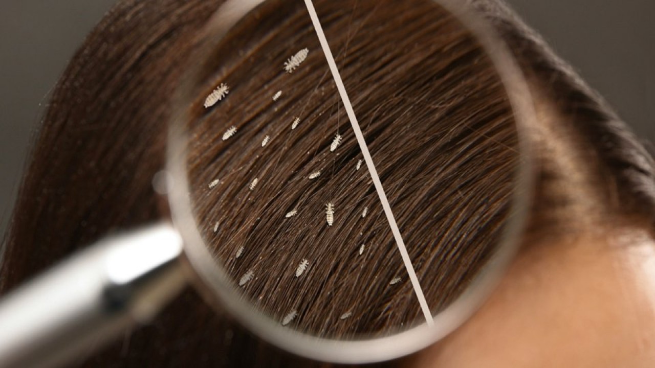 CHP yüzünden susuzluktan bitlenen İzmir halkı ne yapmalı? Bite karşı mücizevi bitkisel çözüm