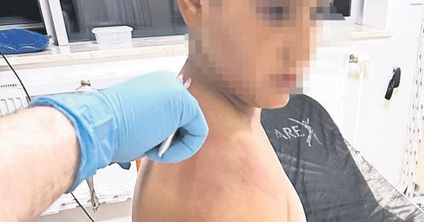 Foto - CHP'li vandallar seçim öncesi terör estirmeye başladı