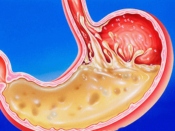Foto - Çiğ et mide kanserine sebep oluyor