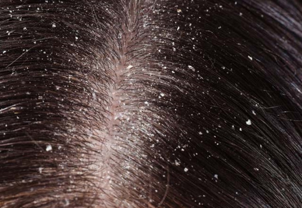 Foto - Cildiniz böyleyse dikkat!