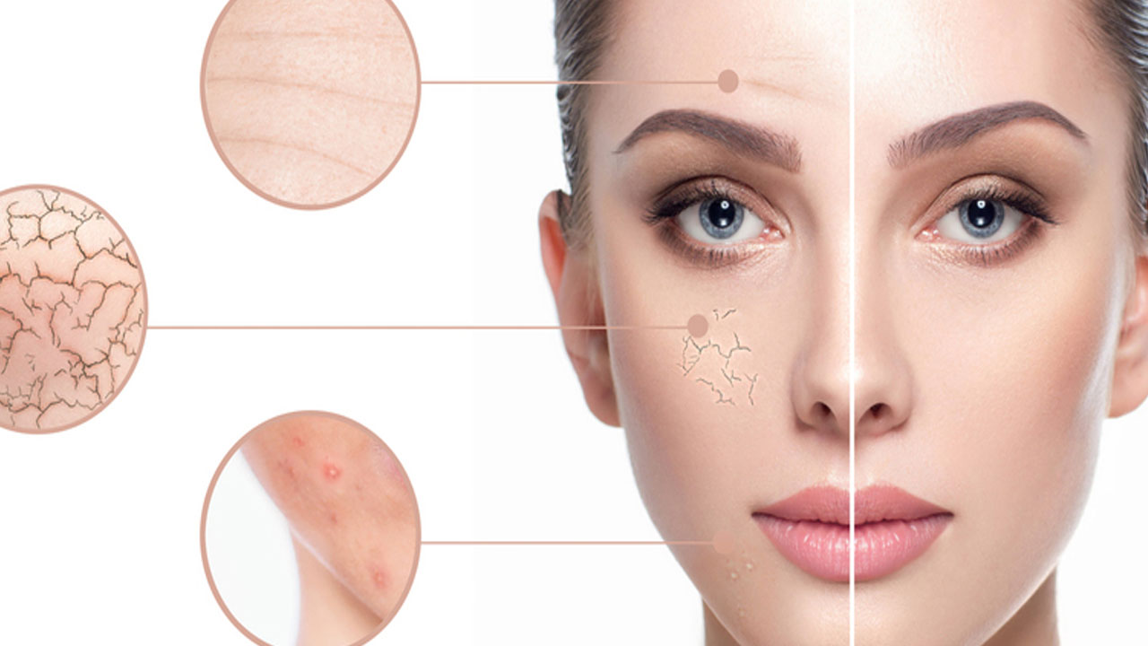 Cildiniz yaşınızı ele vermesin! İsteyenler yapsın: Evde hazırlanan doğal maske, lekeleri silgi gibi siliyor