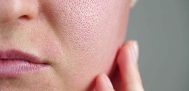 Foto - Cildinize düzenli yoğurt sürerseniz ne olur? Yoğurdun muhteşem faydaları...