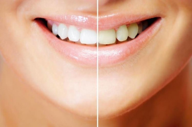 Foto - Çilek diş beyazlatıyor!