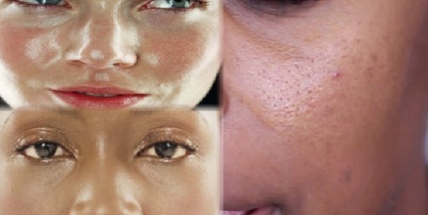 Foto - Cilt tipi nasıl anlaşılır?