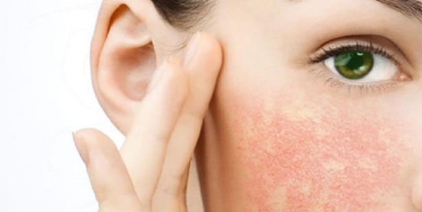 Foto - Cilt tipi nasıl anlaşılır?