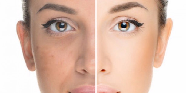 Foto - Cilt tipi nasıl anlaşılır?