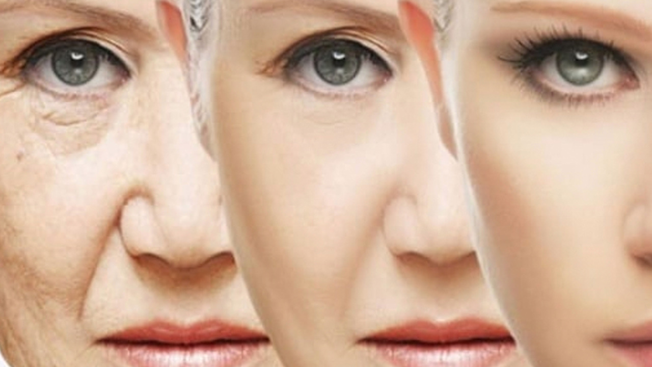 Foto - Ciltte oluşan lekelere son!