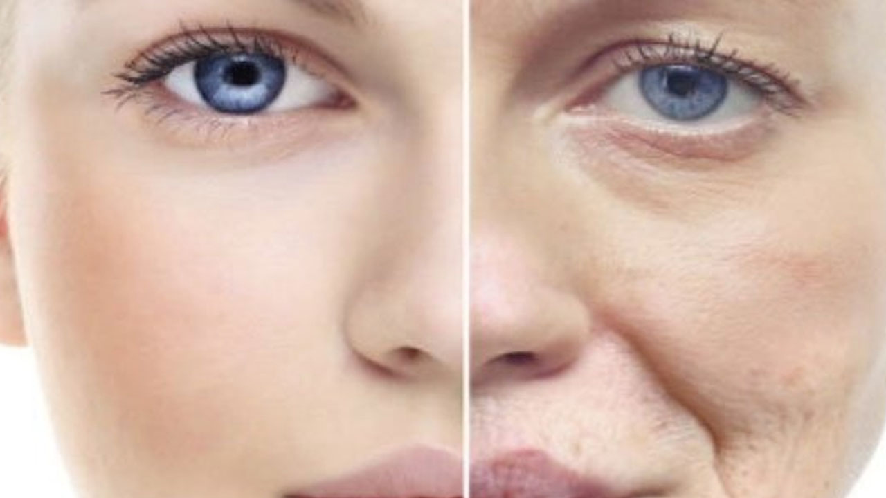 Foto - Ciltte oluşan lekelere son!