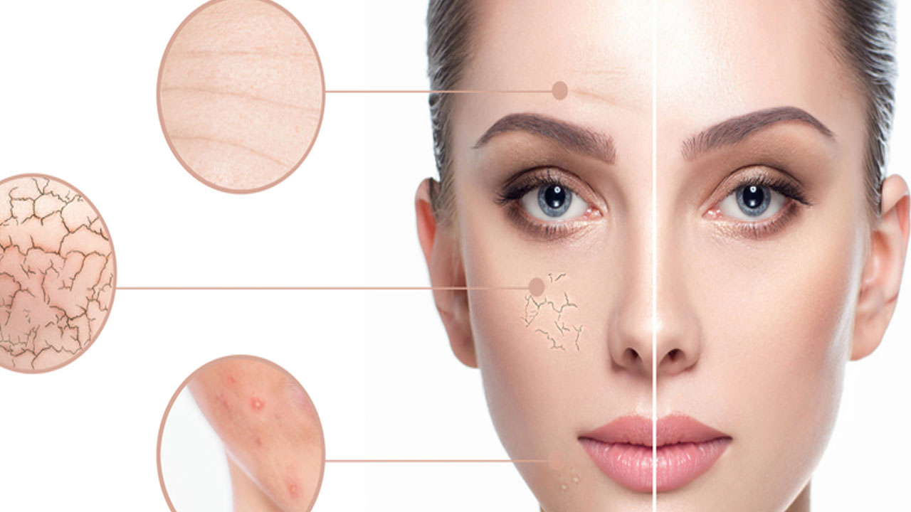 Ciltte oluşan lekelere son!
