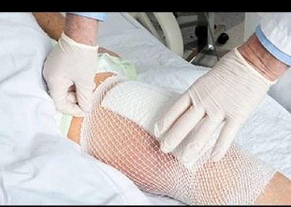 Foto - Çin işi ameliyat