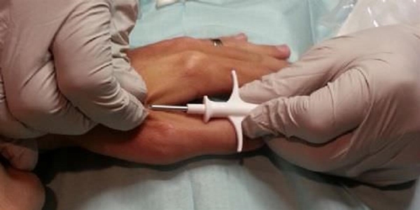 Foto - Çin işi ameliyat