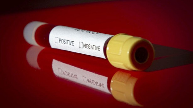 Foto - Çin'deki son koronavirüs gelişmesi gündemi altüst edecek!