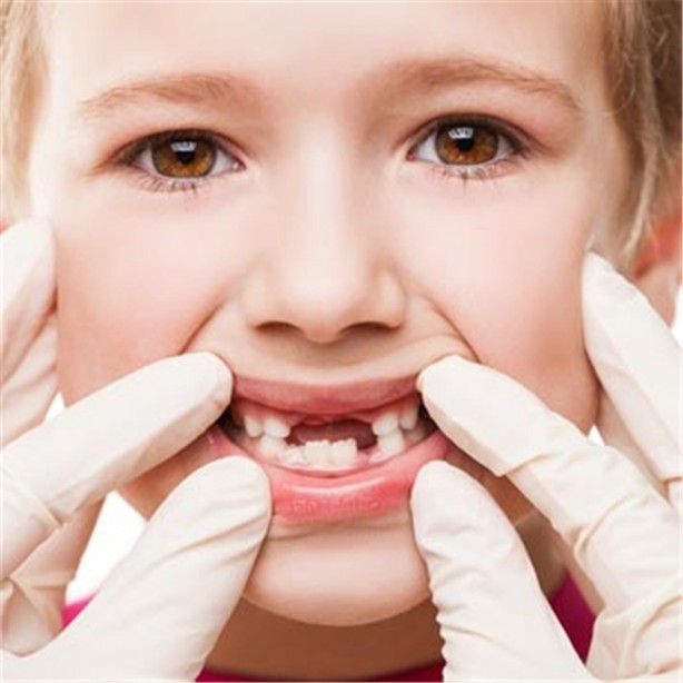 Foto - Çocuğunuz ağzı açık uyuyorsa dikkat!