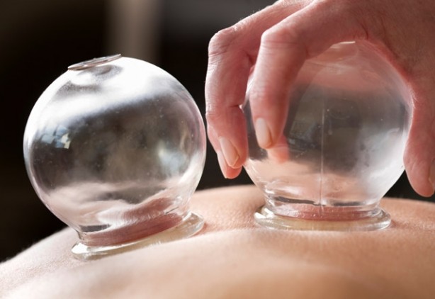 Foto - Çocuklara hacamat yaptırılabilir mi?