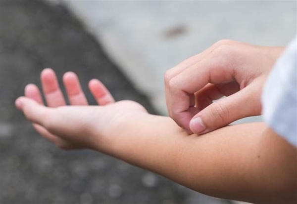 Foto - Çocuklarda vitamin eksikliğini anlamak çok kolay!