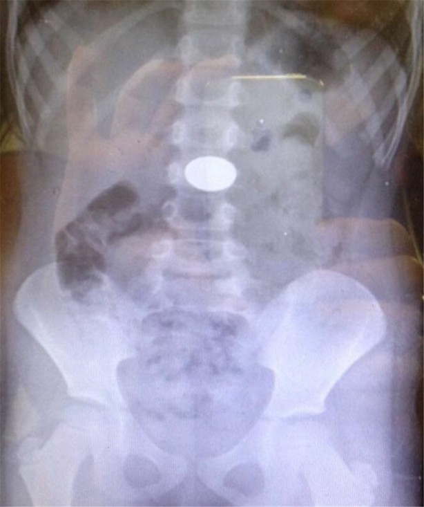 Foto - Çocukların midesinden öyle şeyler çıktı ki!