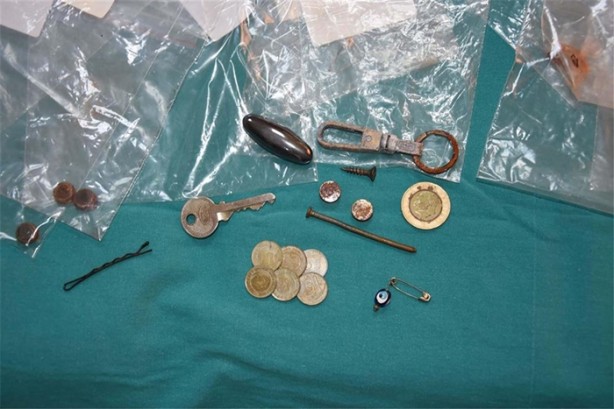 Foto - Çocukların midesinden öyle şeyler çıktı ki!