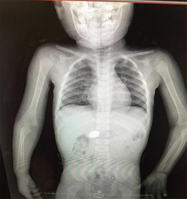 Foto - Çocukların midesinden öyle şeyler çıktı ki!