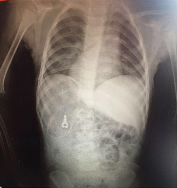 Foto - Çocukların midesinden öyle şeyler çıktı ki!