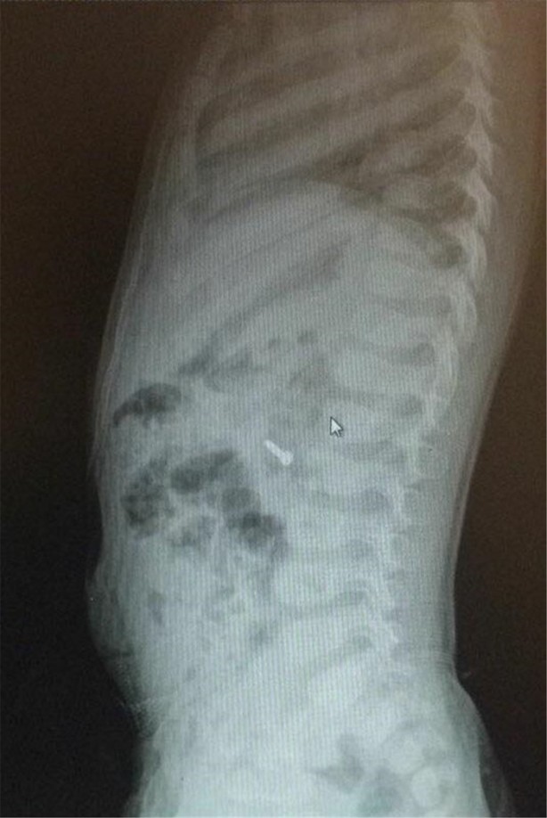 Foto - Çocukların midesinden öyle şeyler çıktı ki!