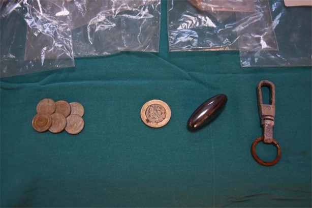 Foto - Çocukların midesinden öyle şeyler çıktı ki!