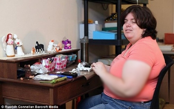 Foto - Çocukluğundan beri 'kör' olmak istiyordu