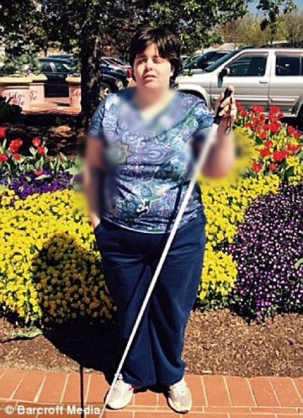 Foto - Çocukluğundan beri 'kör' olmak istiyordu