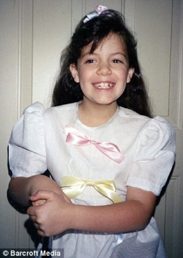 Foto - Çocukluğundan beri 'kör' olmak istiyordu