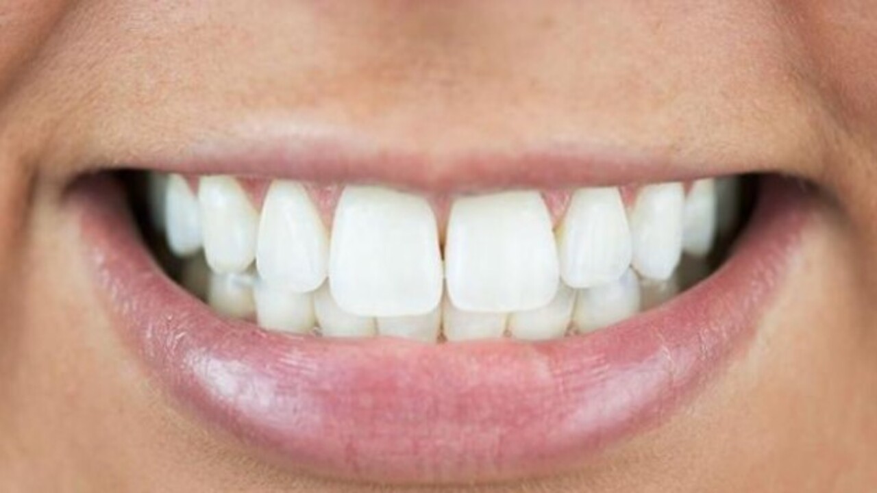 Foto - Çok büyük yanlış yapıyor muşuz! Dişleri beyazlattığı sanılıyordu ama gerçek başka