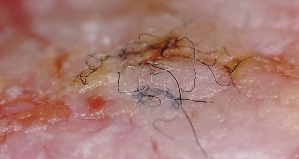 Foto - Çok nadir görülüyor! Tıp dünyasının sıradışı 10 hastalığı