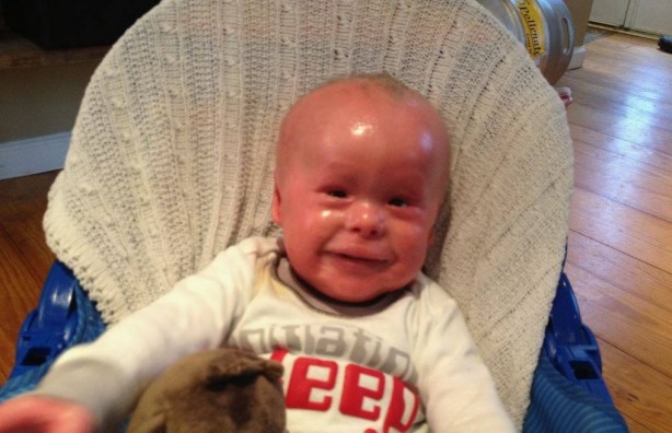 Foto - Çok nadir görülüyor! Tıp dünyasının sıradışı 10 hastalığı