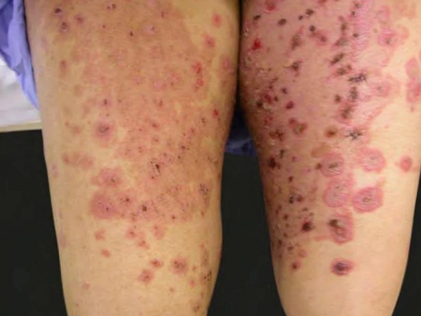 Foto - Çok nadir görülüyor! Tıp dünyasının sıradışı 10 hastalığı