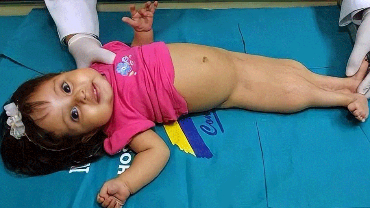 Foto - Çok nadir rastlanıyor! İşte dünyanın en tuhaf hastalıkları!