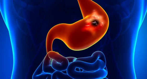 Foto - Çok tüketiliyor ama... Kritik uyarı! İşte limonlu su içmenin zararları...