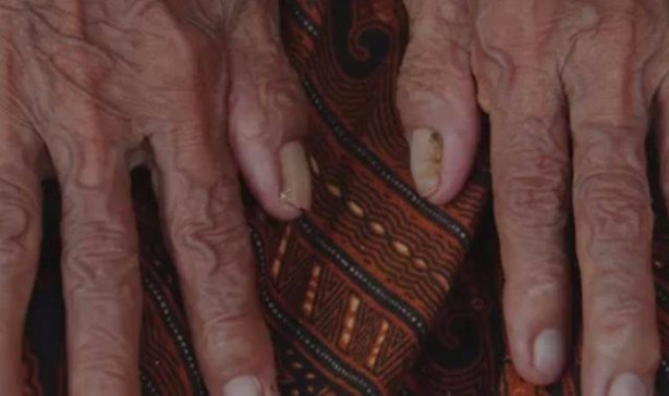 Foto - Çöken tampon fön makinesiyle nasıl düzeltilir?