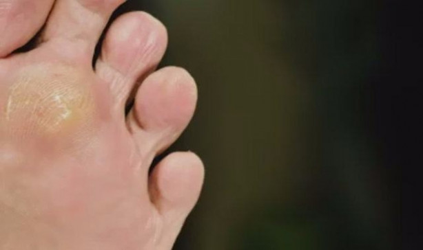 Foto - Çöken tampon fön makinesiyle nasıl düzeltilir?