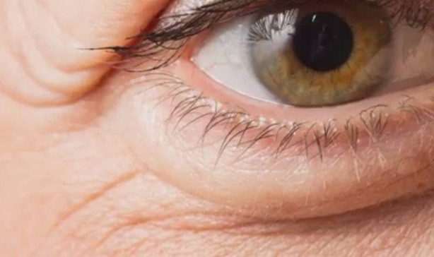 Foto - Çöken tampon fön makinesiyle nasıl düzeltilir?