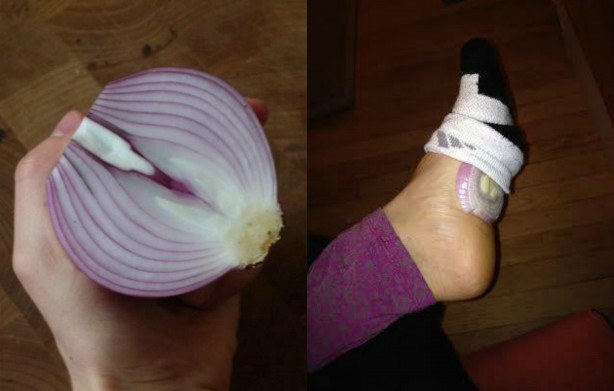 Foto - Çorabınızın için yarım soğan koyup sabaha kadar beklerseniz bakın ne olur? Herkes bunu yapıyor