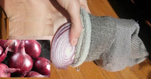 Foto - Çorabınızın için yarım soğan koyup sabaha kadar beklerseniz bakın ne olur? Herkes bunu yapıyor